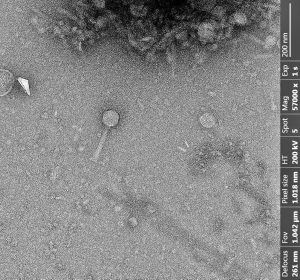 Bacteriófagos: Del laboratorio a los campos de cerezos