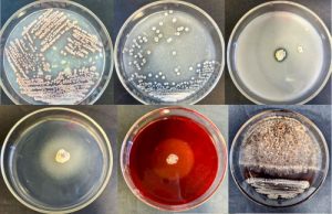 Agromega: apuesta por los productos biológicos para una agricultura moderna